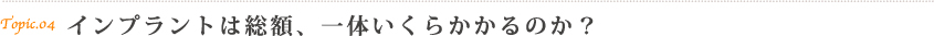 インプラントの費用について