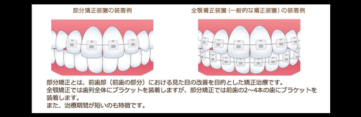 矯正歯科