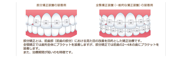 矯正歯科
